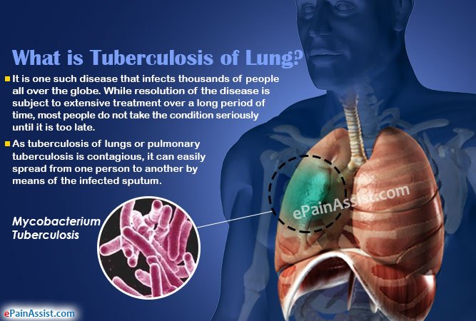 what-tuberculosis-lung.jpg