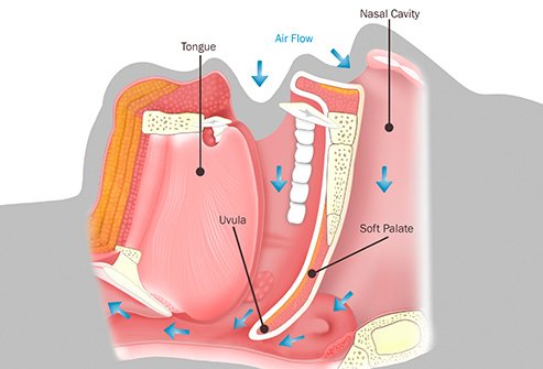 snoring_diagram.jpg