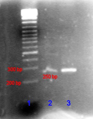 Pcr_gel-.jpg