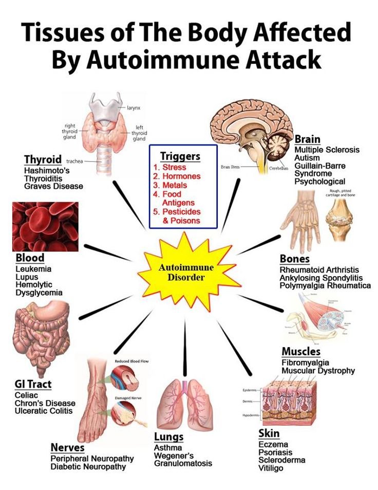 Summary of autoimmune diseases.jpg