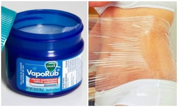 vick-vaporub-para-adelgazar-abdomen.jpg