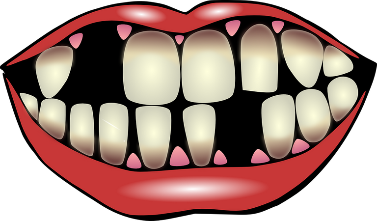 dental-hygiene-156103_960_720.png