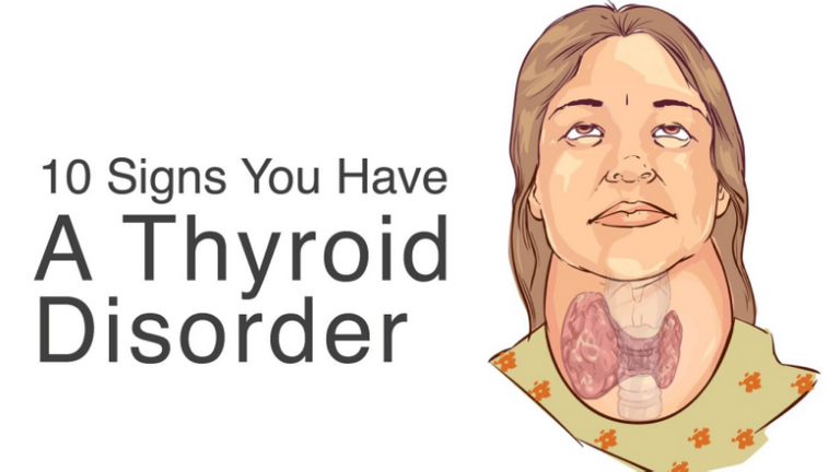 signs-you-have-a-thyroid-disorder.png