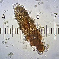 200px-TardigradeEggsInShedCuticle.jpg