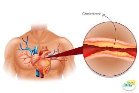 Cholesterol.jpg