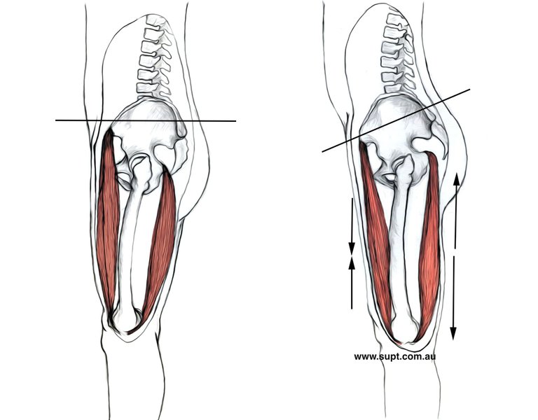 Neutral pelvis.jpg