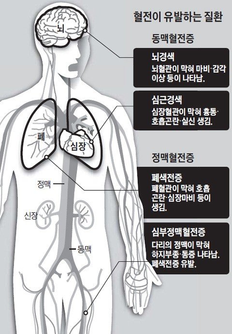 미세먼지_6.jpg