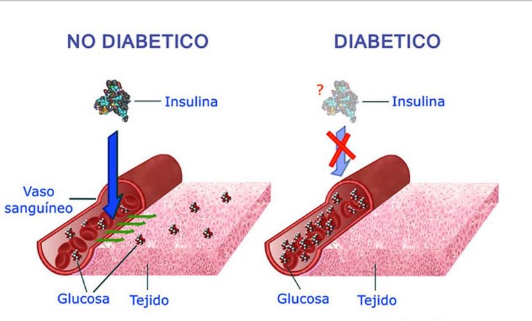 Diabetes-Mellitus-Clasificacion.jpg