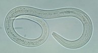 194x105_Hookworm_Infections.jpg