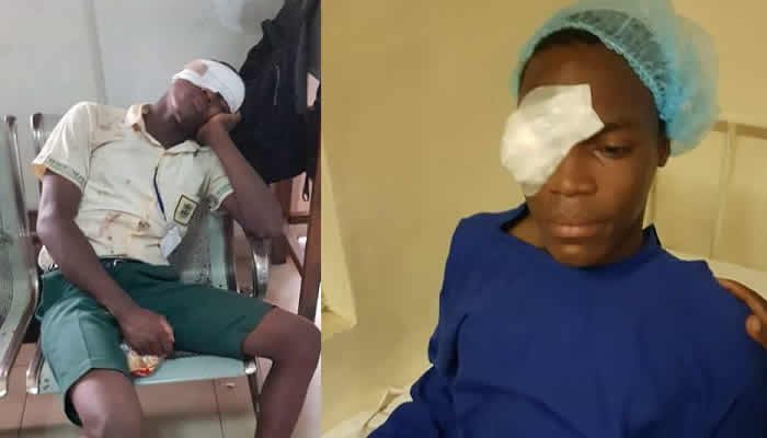 lagos-secondary-student-stabbed-in-the-eye-by-fellow-student.jpg