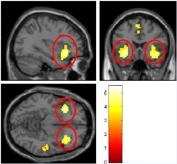 insula-activity.jpg