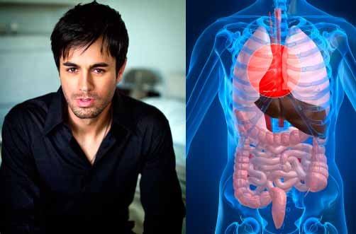 Situs-Inversus-Enrique-Iglesias-Organos-Invertidos-Heterotaxia-Dextrocardia-Levocardia.jpg