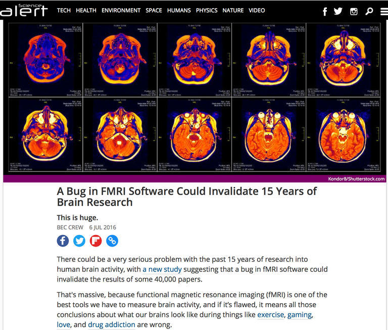 A bug in FMRI sotware could invalidate 15years of brainresearch.png