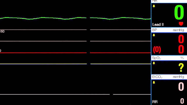 17553920_10208519798414904_393268547442765152_n.jpg