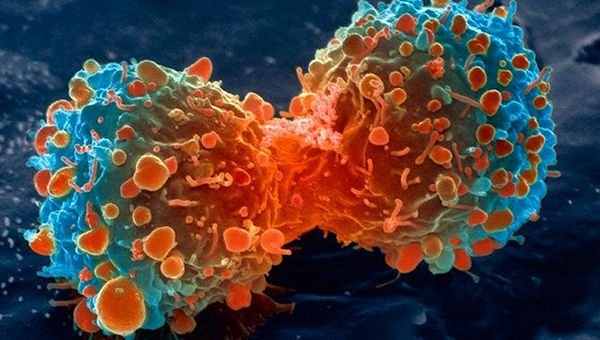lung-cancer-cell-dividing-article.__v400248237.jpg