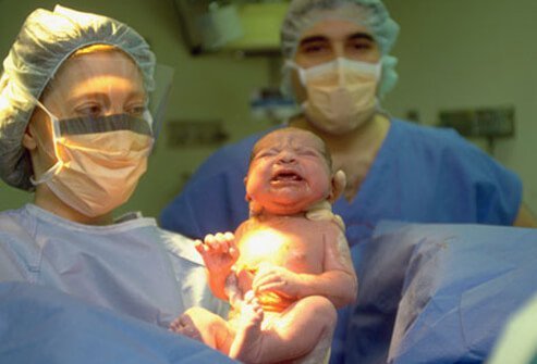 fetal_newborn_at_birth_s13.jpg