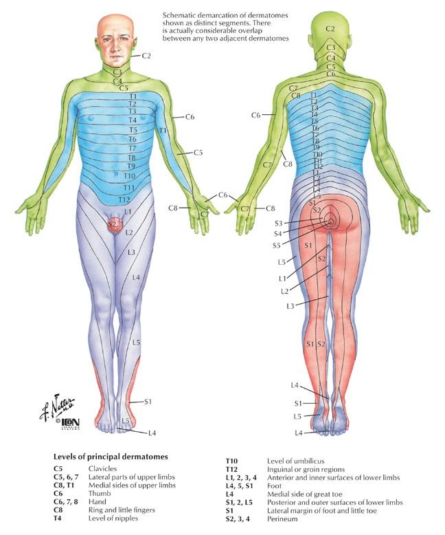 06-4 Radiculopathy.jpg