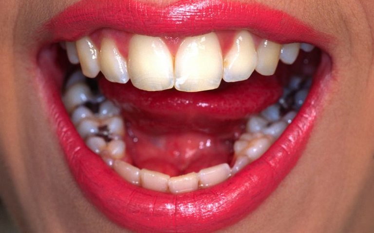 the-poison-in-your-teeth-800x500.jpg