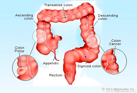 detail_colon_cancer.jpg