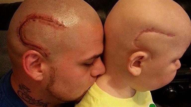 Falleció el niño de la imagen viral junto a su padre tatuado.jpg