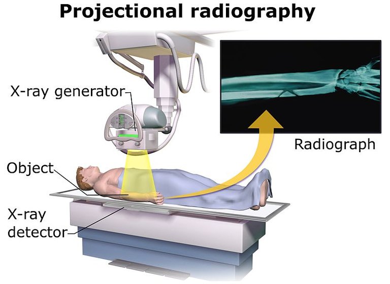 Projectional_radiography_components.jpg