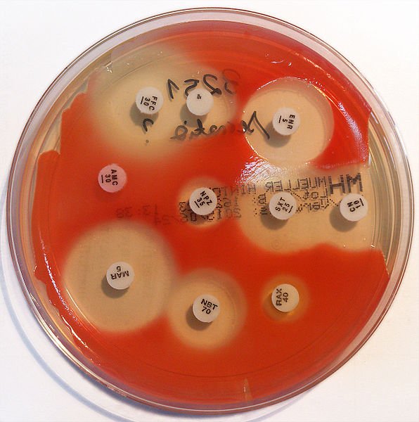 Serratia_marcescens_-_antibiogram.jpg