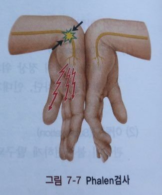 KakaoTalk_20170712_124347678.jpg