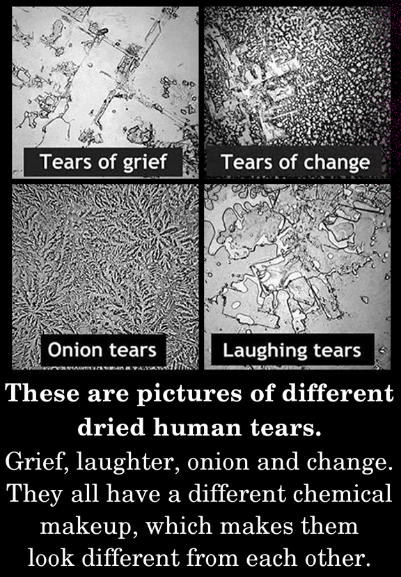 These are pictures of different dried human tears.m.png