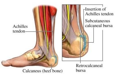 400xNxtendon-de-aquiles.jpg,qitok=ez6J6DBk.pagespeed.ic.dMpxmVfTBO.jpg