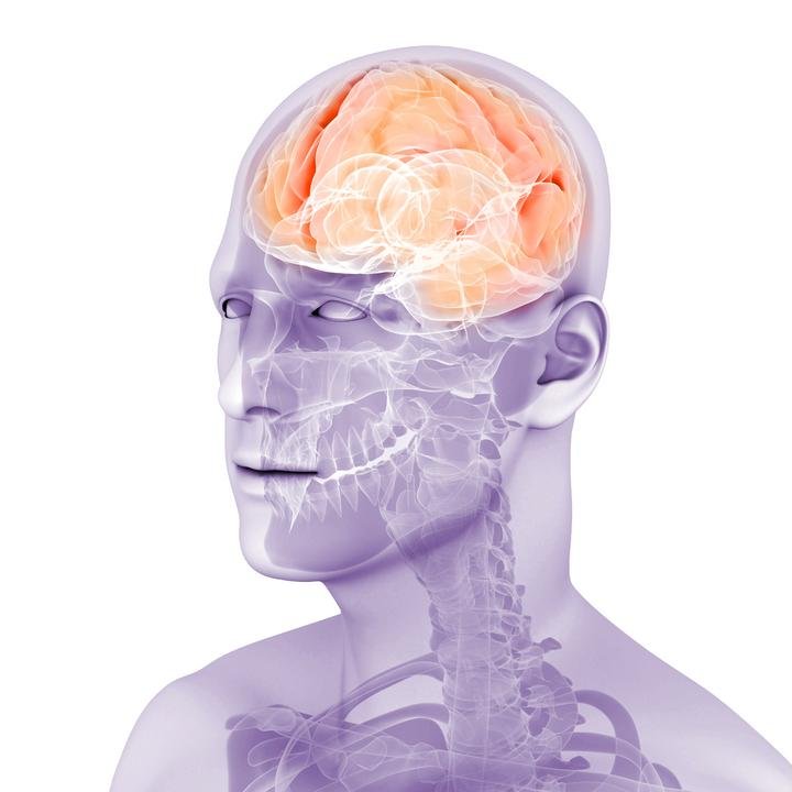 paralisis-supranuclear-progresiva-parkinsonismo.jpeg