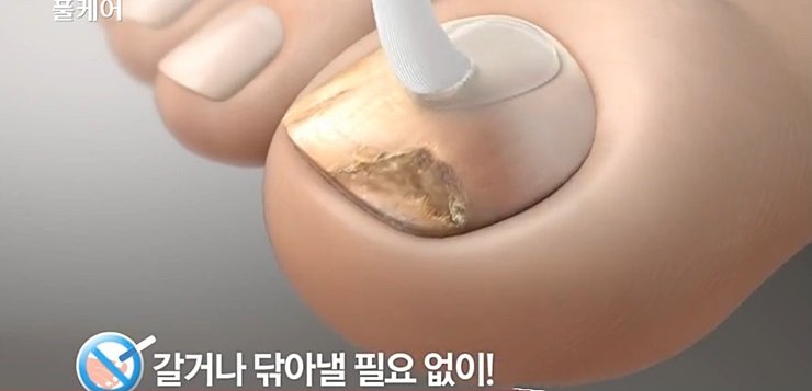 풀케어2.jpg