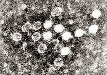 220px-Parvovirus_in_Blood.jpg