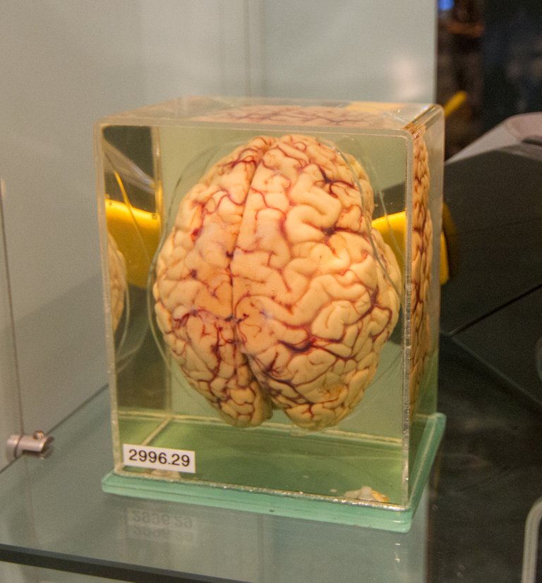 Human_brain_preserved_in_formaldehyde.jpg