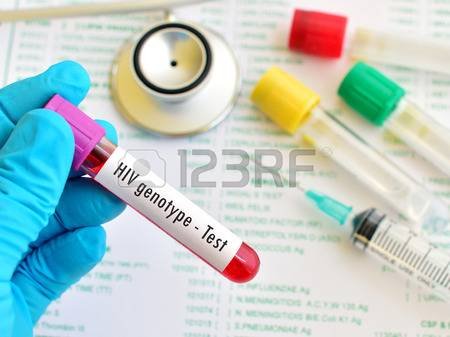 55234957-test-tube-with-blood-sample-for-hiv-genotype-test.jpg