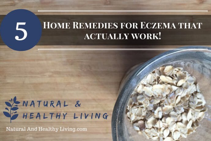 home-remedies-for-eczema-690x460.jpg