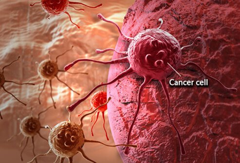 cancer-101-s1-what-is-cancer-cell.jpg