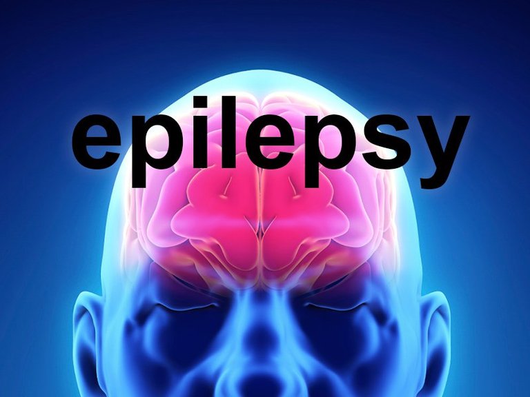 is_151209_brain_epilepsy_800x600.jpg