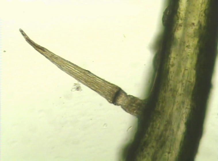 Microscope image of trigger hair