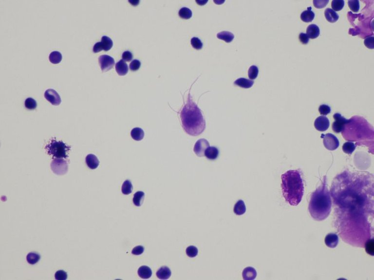 File:Giardia lamblia cytology.jpg
