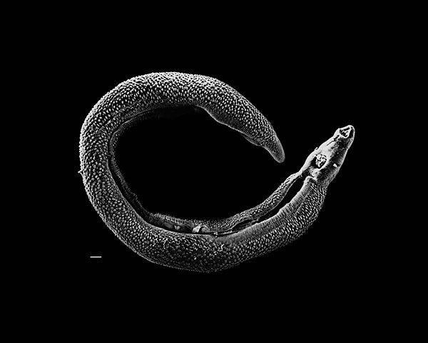 Electron micrograph of an adult male Schistosoma parasite worm. The bar (bottom left) represents a length of 500 μm.