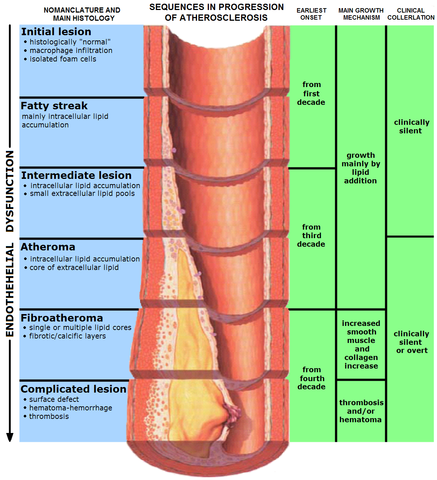 Stages of endothelial dysfunction in atherosclerosis