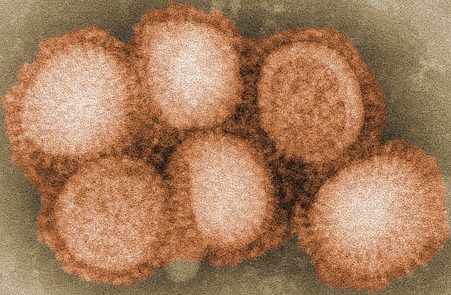 Bird flu, H1N1 virus