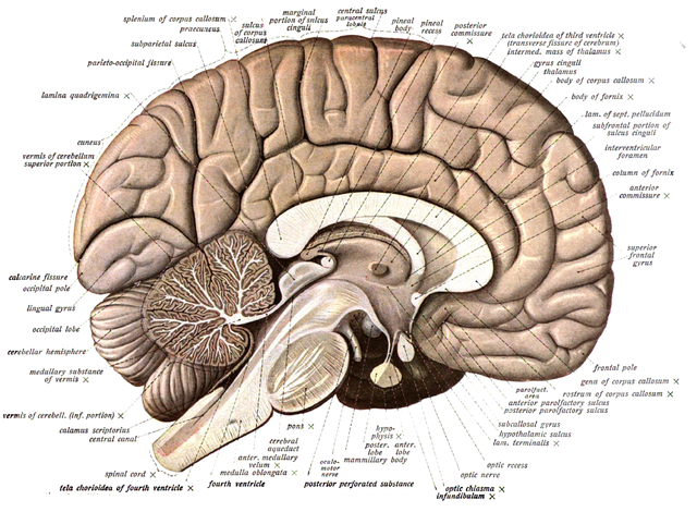 Human brain bisected in the sagittal plane, showing the white matter of the corpus callosum