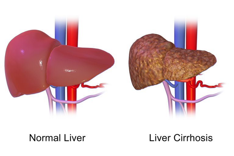 Liver