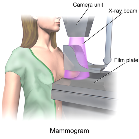 Illustration of a mammogram