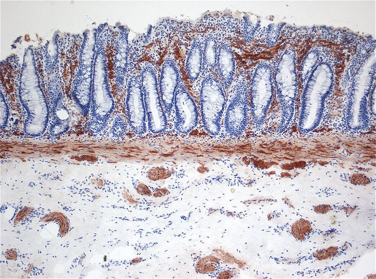 Hirschsprung acetylcholine.jpg