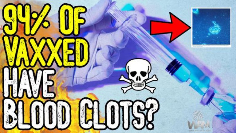 Study: 94% Of VAXXED Have PRE-BLOOD CLOT FORMATIONS! - Shocking Evidence EXPOSED!