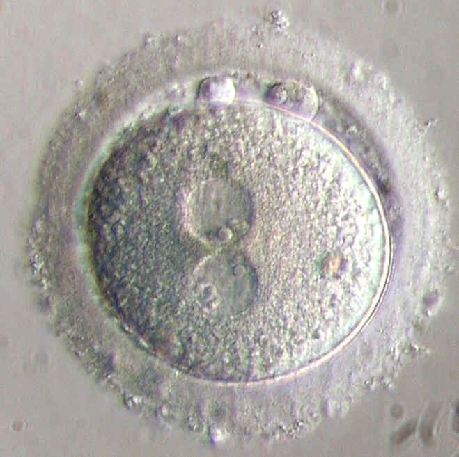 Human Zygote