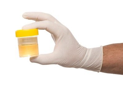 Image result for urine drug test