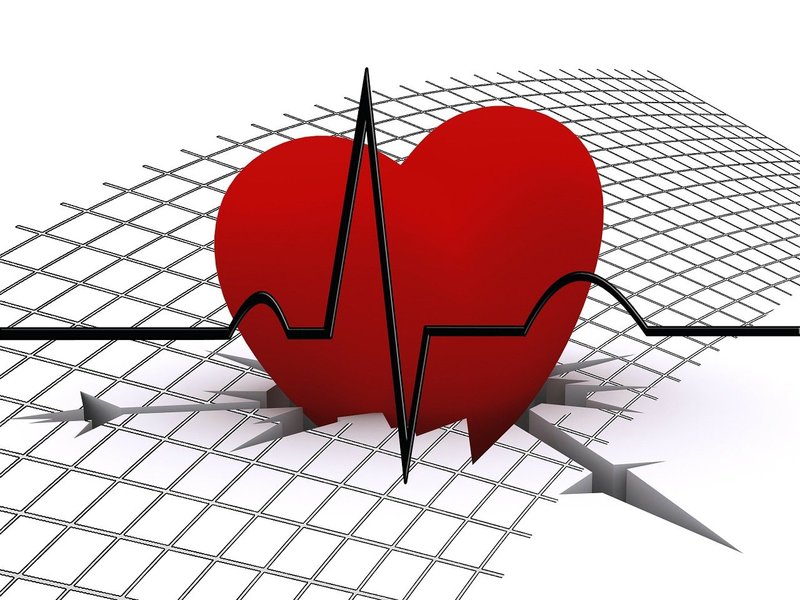 I Don’t Like ECGs Very Much